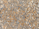 Immunohistochemistry of paraffin-embedded Human tonsil tissue using HTT Polyclonal Antibody at dilution of 1:30(×200)