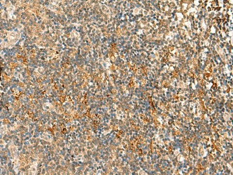 Immunohistochemistry of paraffin-embedded Human tonsil tissue using HTT Polyclonal Antibody at dilution of 1:30(×200)