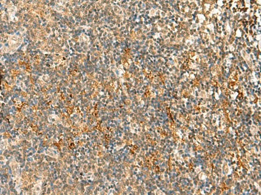 Immunohistochemistry of paraffin-embedded Human tonsil tissue using HTT Polyclonal Antibody at dilution of 1:30(×200)