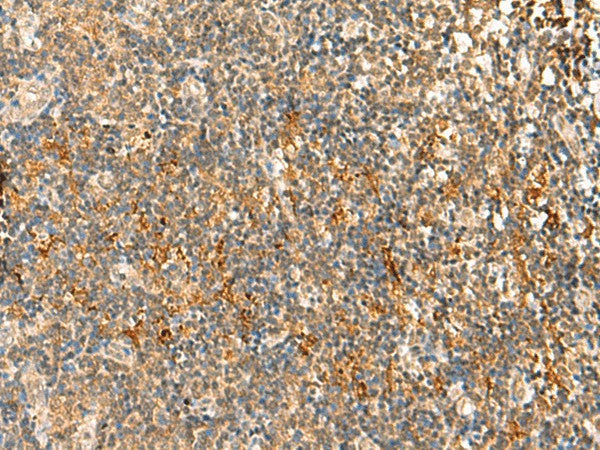 Immunohistochemistry of paraffin-embedded Human tonsil tissue using HTT Polyclonal Antibody at dilution of 1:30(×200)