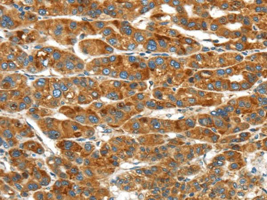 Anti-Human/Mouse ERP44 Antibody - ABMIUM