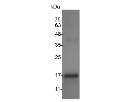 Recombinant Swine GM-CSF protein(His Tag) - ABMIUM