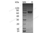 Recombinant Human JAM-B/CD322 Protein (Fc Tag) - ABMIUM