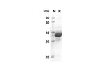 SDS-PAGE analysis of Rat CXCI3 proteins, 2 μg/lane of Recombinant Rat CXCI3 proteins was resolved with SDS-PAGE under reducing conditions, showing bands at 39.6 kDa.