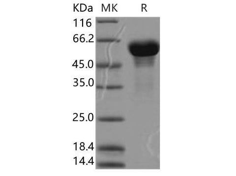 Recombinant Human Secretogranin 3/SCG3 Protein (His Tag) - ABMIUM