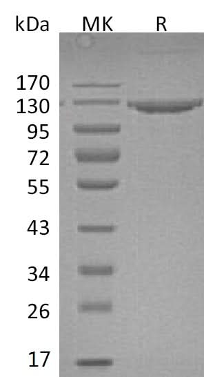 Recombinant Mouse VCAM1 Protein (Fc Tag) - ABMIUM