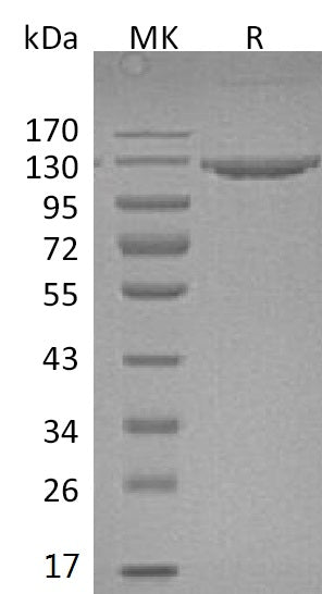 Recombinant Mouse VCAM1 Protein (Fc Tag) - ABMIUM
