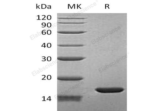 Recombinant Human BLBP/FABP7 Protein (His Tag) - ABMIUM