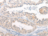 Anti-Human/Mouse/Rat ANAPC15 Antibody - ABMIUM