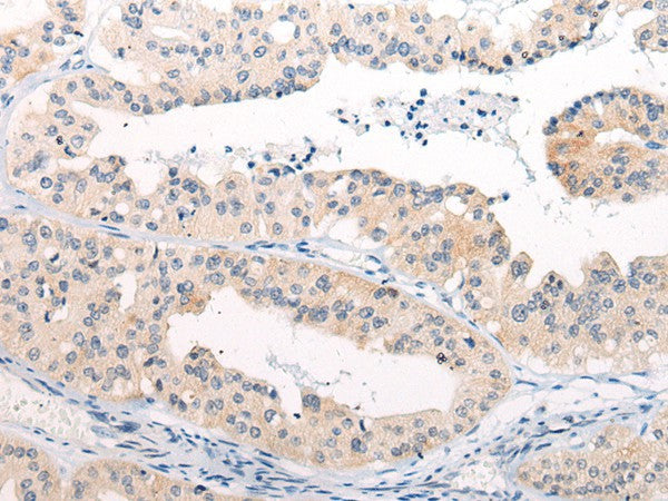 Anti-Human/Mouse/Rat ANAPC15 Antibody - ABMIUM