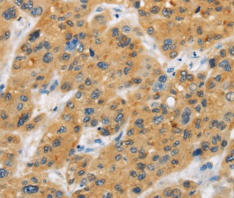 Anti-Human BTLA Antibody - ABMIUM