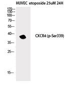 Western Blot analysis of HuvEc etoposide 25uM 24h cells with Phospho-CXCR4 (Ser339) Polyclonal Antibody