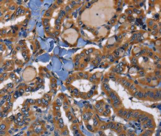 Anti-Human/Mouse/Rat EPHB6 Antibody