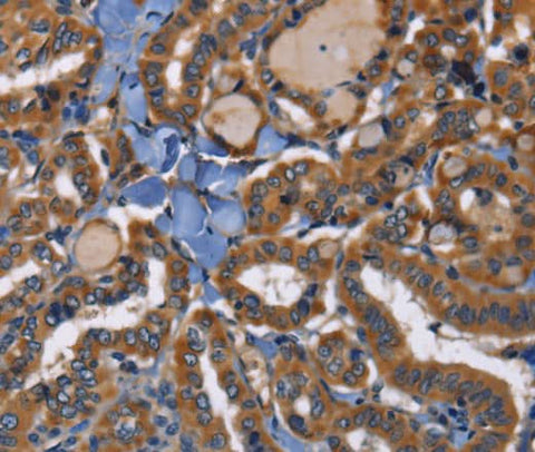 Anti-Human/Mouse/Rat EPHB6 Antibody - ABMIUM