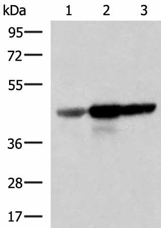Western blot analysis of Human fetal brain tissue HepG2 and HT29 cell lysates using FDFT1 Polyclonal Antibody at dilution of 1:1000