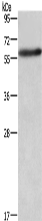 Anti-Human/Mouse/Rat AMIGO2 Antibody - ABMIUM