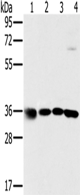Anti-Human/Mouse MRPL39 Antibody - ABMIUM