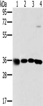 Anti-Human/Mouse MRPL39 Antibody - ABMIUM