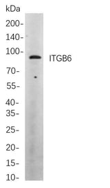 Anti-Human/Mouse/Rat ITGB6 Antibody [B868]