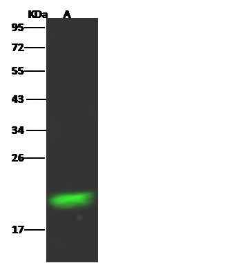 Anti-Mouse RBP4 Antibody [B416] - ABMIUM