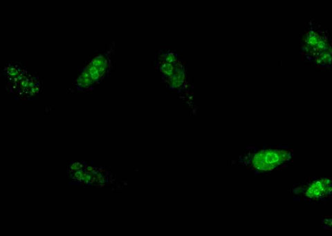 Anti-Human MKI67 Antibody [A1076] - ABMIUM