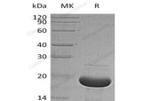 Recombinant Human Alpha-Synuclein/SNCA Protein (His Tag) - ABMIUM