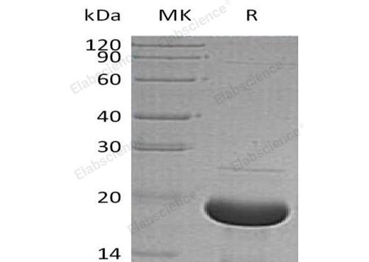 Recombinant Human Alpha-Synuclein/SNCA Protein (His Tag) - ABMIUM