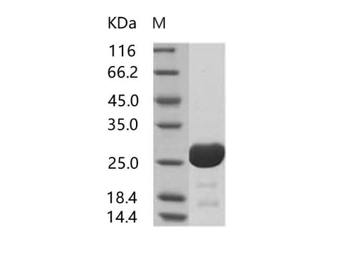 Recombinant HIV-1 p24 Protein (group O, strain BCF06) (His Tag) - ABMIUM