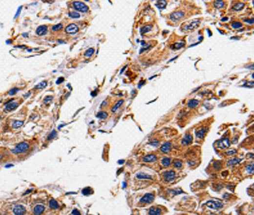 Anti-Human RAB41 Antibody