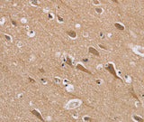 Anti-Human RAB6C Antibody - ABMIUM