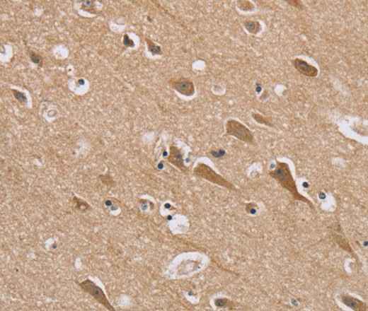 Anti-Human RAB6C Antibody