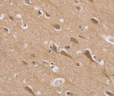 Anti-Human RAB6C Antibody