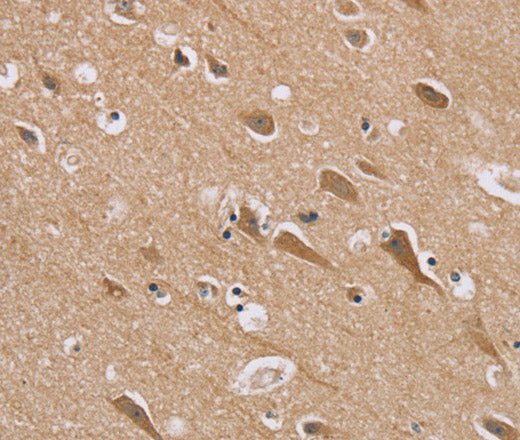 Anti-Human RAB6C Antibody - ABMIUM