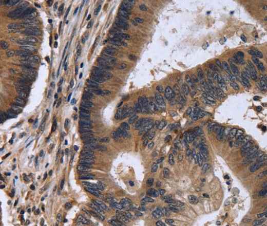 Anti-Human/Mouse/Rat FSTL1 Antibody
