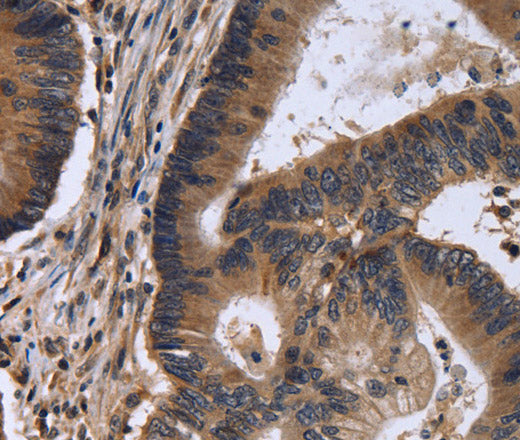 Anti-Human/Mouse/Rat FSTL1 Antibody - ABMIUM