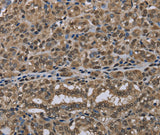 Anti-Human NLRP6 Antibody - ABMIUM