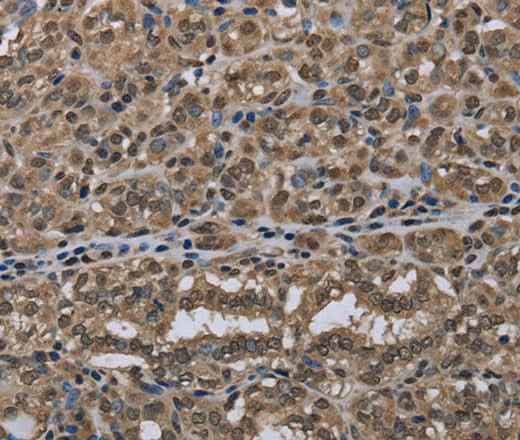 Anti-Human NLRP6 Antibody