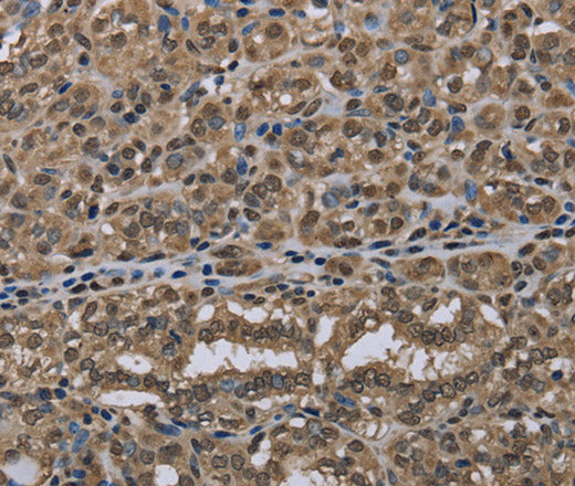 Anti-Human NLRP6 Antibody - ABMIUM
