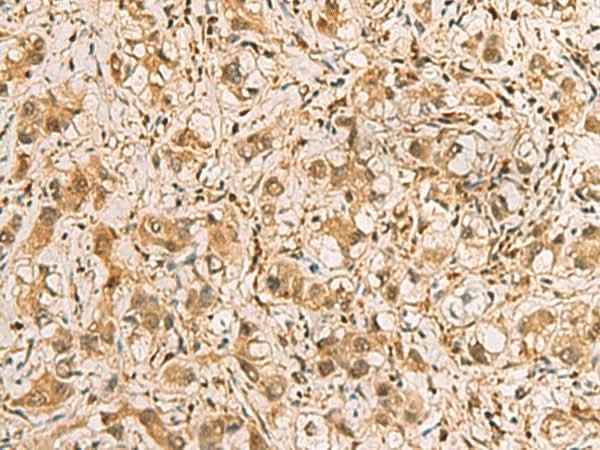 Anti-Human/Mouse/Rat PDXK Antibody