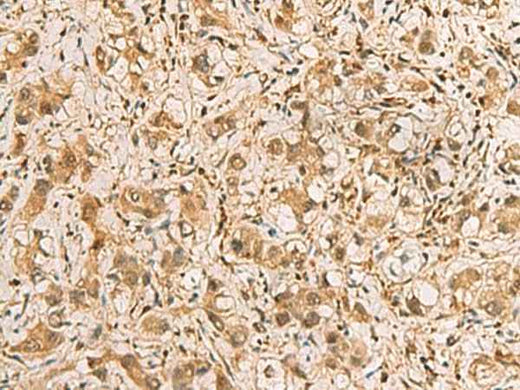Anti-Human/Mouse/Rat PDXK Antibody
