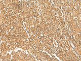 Immunohistochemistry of paraffin-embedded Human tonsil tissue using GTF3A Polyclonal Antibody at dilution of 1:75(×200)
