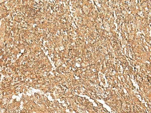 Anti-Human/Mouse/Rat GTF3A Antibody