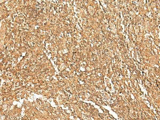 Anti-Human/Mouse/Rat GTF3A Antibody