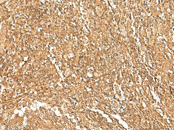 Immunohistochemistry of paraffin-embedded Human tonsil tissue using GTF3A Polyclonal Antibody at dilution of 1:75(×200)