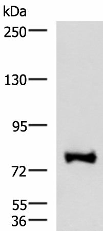 Western blot analysis of TM4 cell lysate using FOXK2 Polyclonal Antibody at dilution of 1:1000