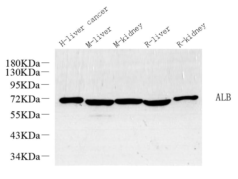 Western Blot analysis of various samples using ALB Polyclonal Antibody at dilution of 1:1000.