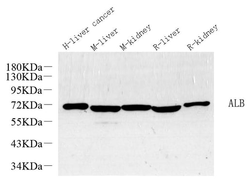 Western Blot analysis of various samples using ALB Polyclonal Antibody at dilution of 1:1000.
