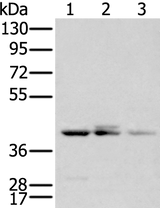 Anti-Human APOBEC3D Antibody - ABMIUM