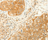 Anti-Human RARRES1 Antibody - ABMIUM