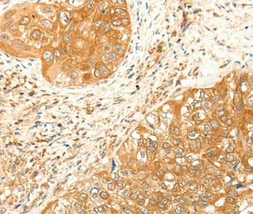 Anti-Human RARRES1 Antibody - ABMIUM